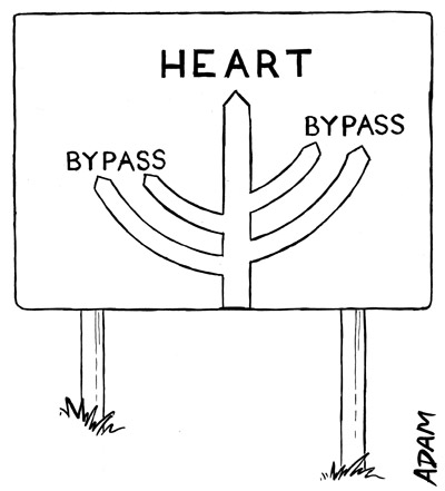 Heart bypass